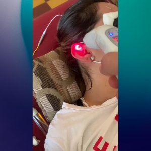 Aplicación de laser en auriculoterapia