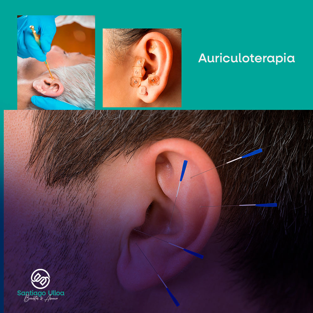 Auriculoterapia-para-el-Dolor